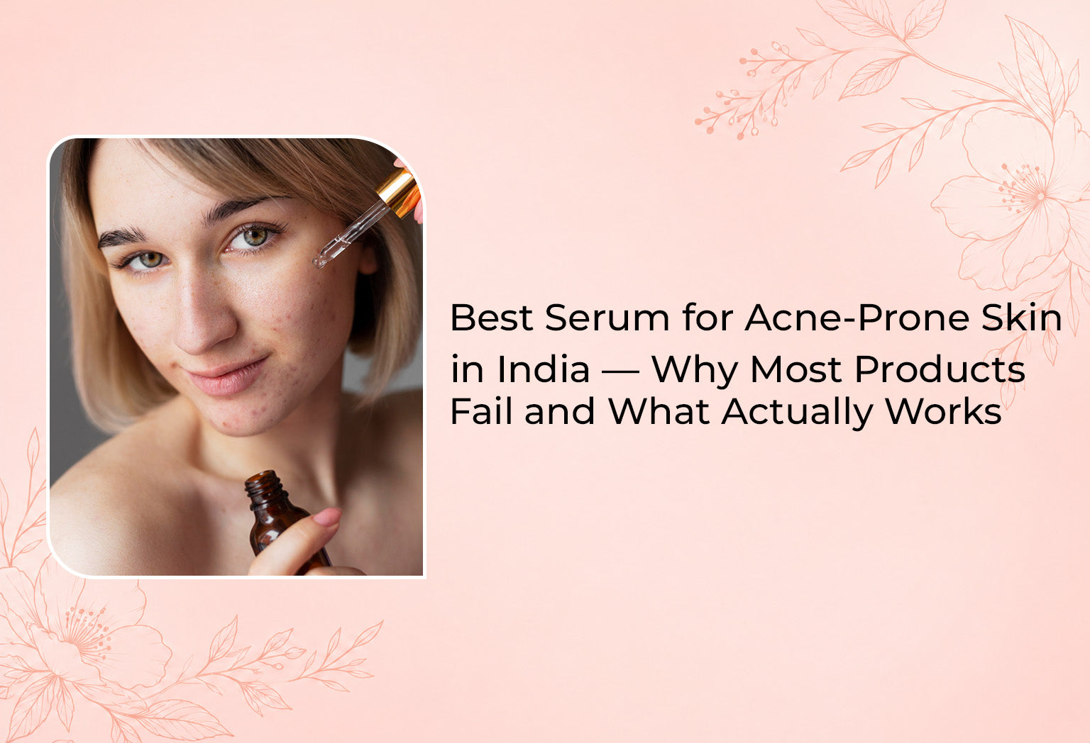 Serum for Acne-Prone Skin