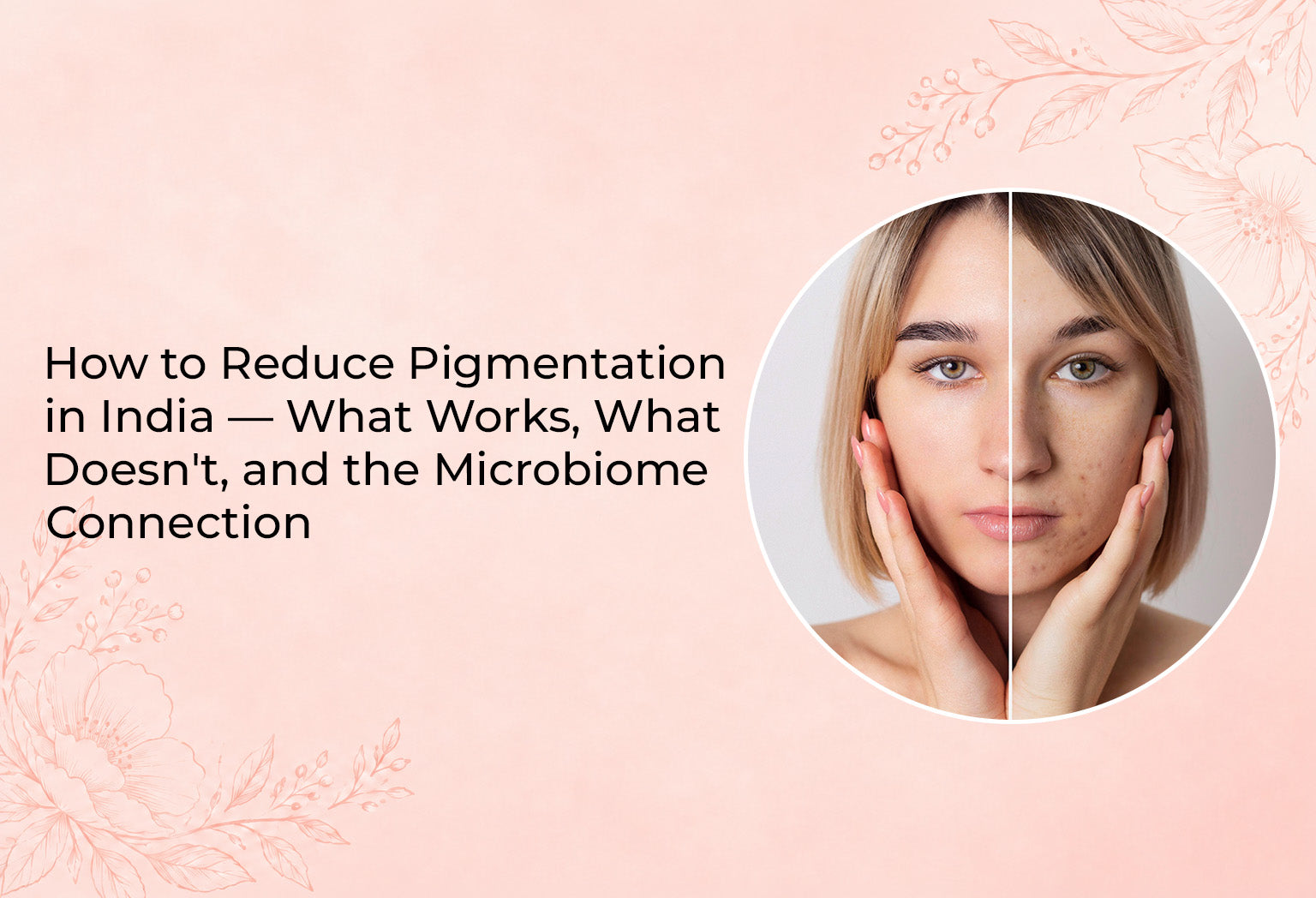 Reduce Pigmentation